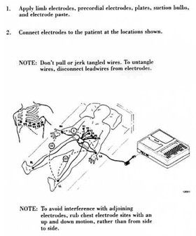 Figure 1. Electrode and Leadwire Placement 6.3.2