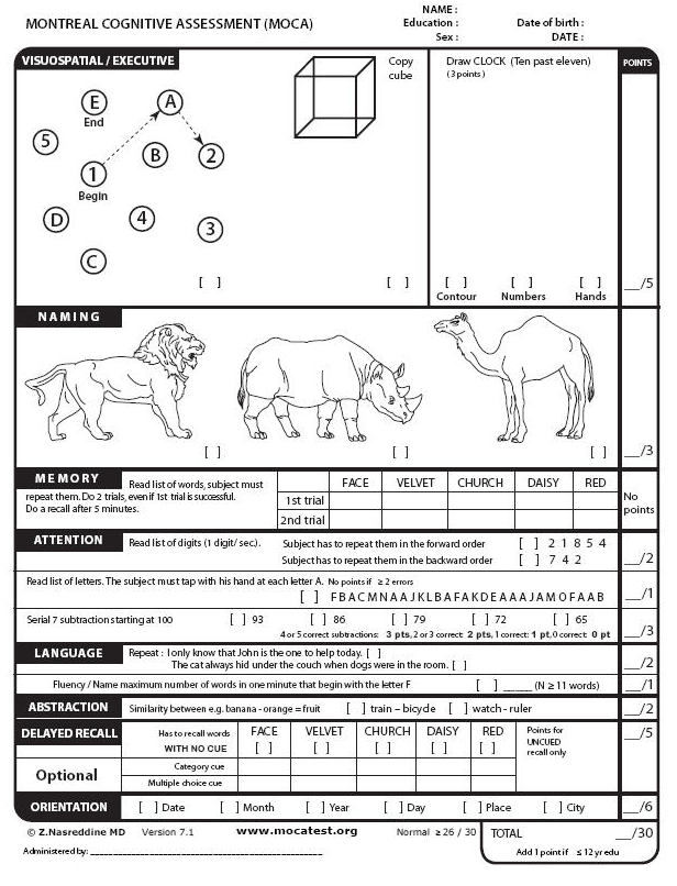 MoCA Test